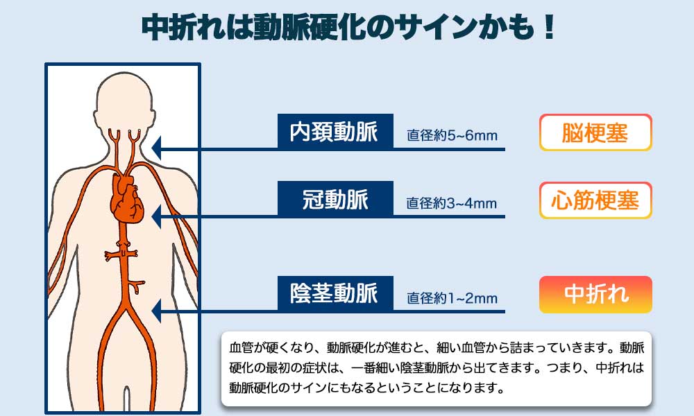 中折は動脈硬化のサインになるうる。